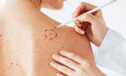 OMS presentó aplicación móvil para prevenir cáncer de piel