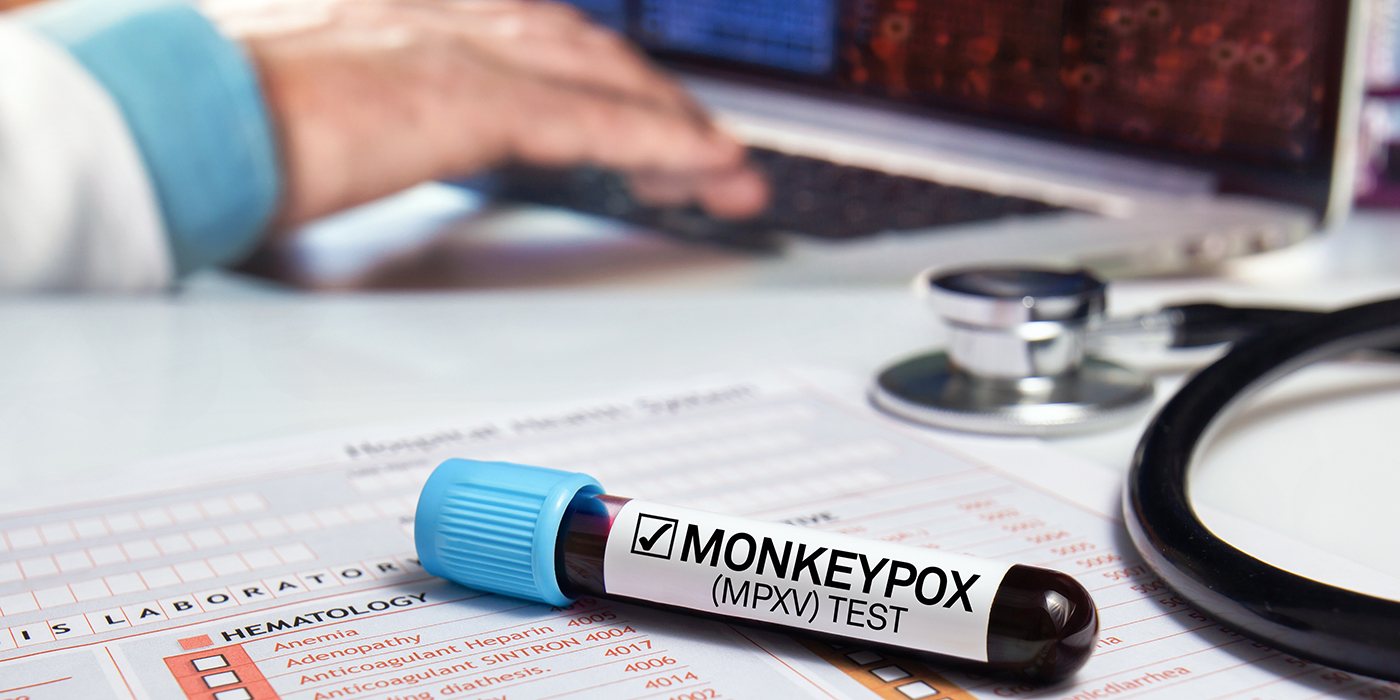 Expertos se capacitan para detectar la viruela del mono | FOTO AGENCIAS