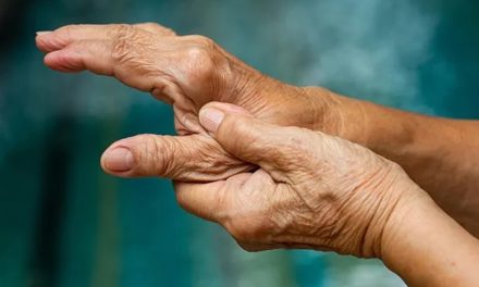 Cinco consejos para prevenir la artritis reumatoide