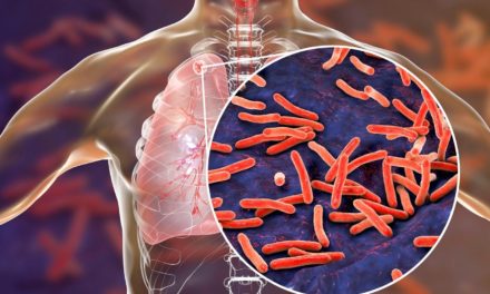 OMS pide más inversiones para combatir la tuberculosis