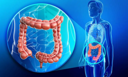 Cáncer de colon: Una colonoscopia a tiempo puede salvar vidas
