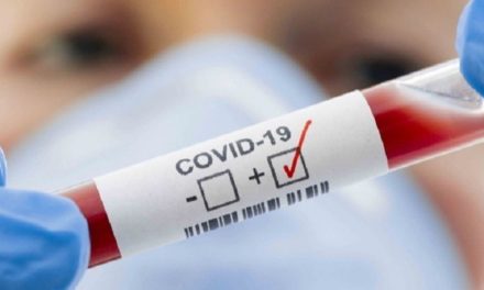 Más de 379 millones de contagios por Covid-19 se registran en el mundo