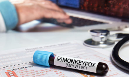 Expertos de América se capacitan en la detección de la viruela del mono