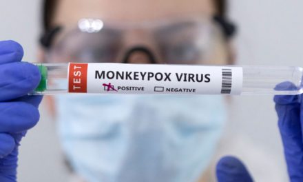 Reportan alza en demanda de pruebas para detección de viruela símica