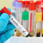 Alerta por enfermos de brucelosis en Ecuador
